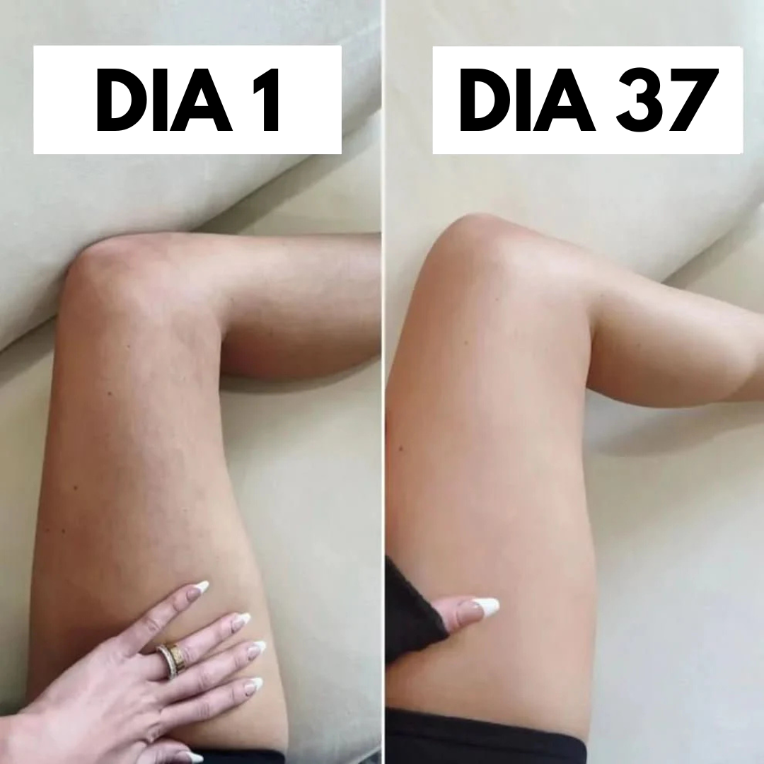 Kit Anticelulítico REVITALIF™