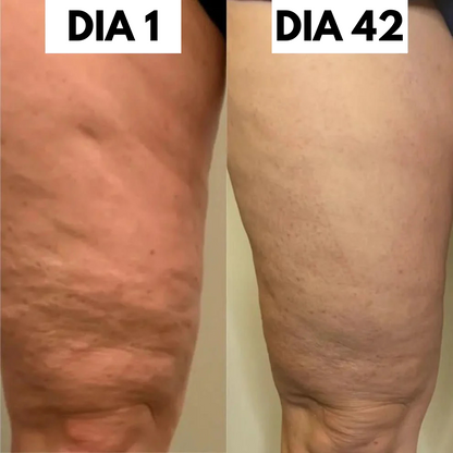Kit Anticelulítico REVITALIF™