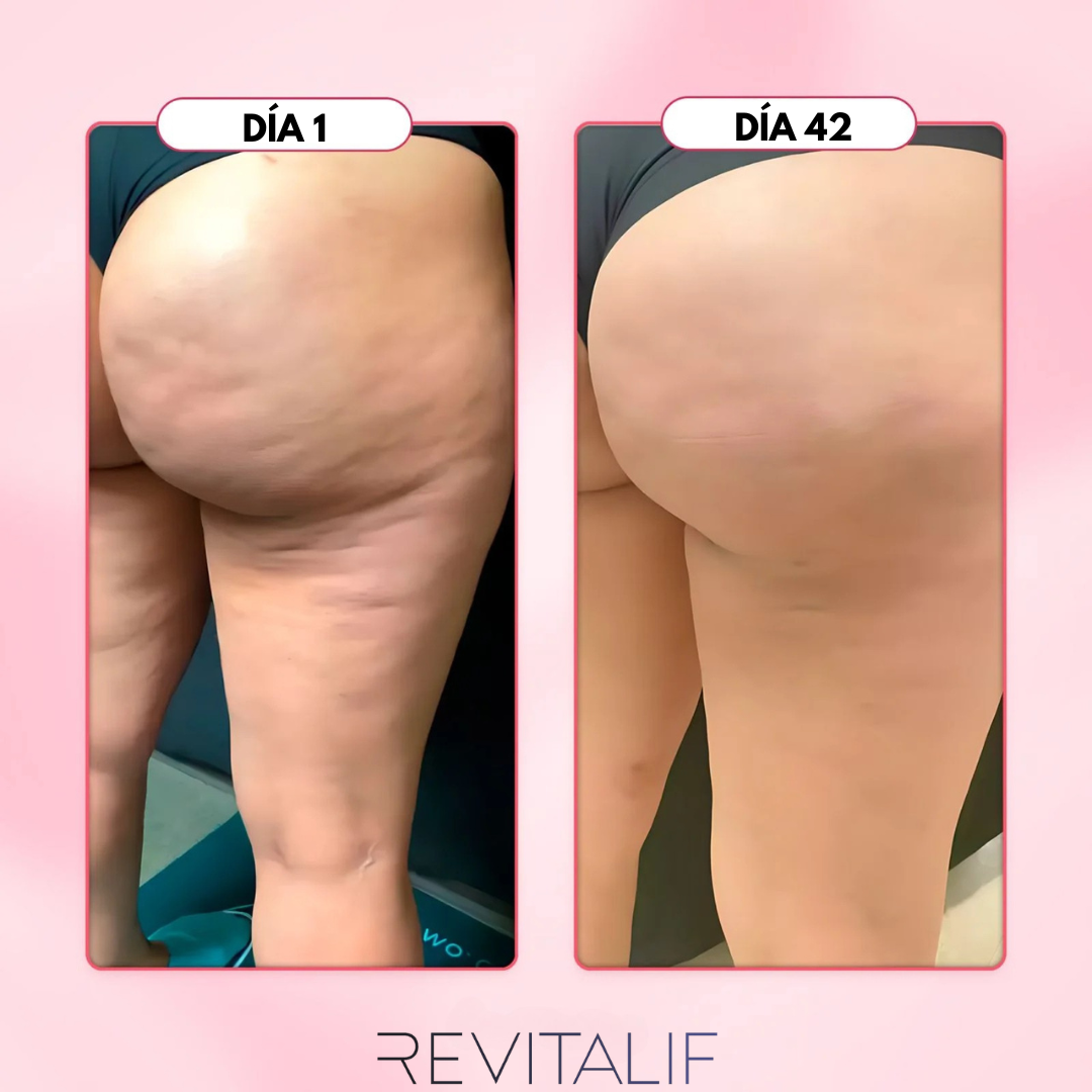 Kit Anticelulítico REVITALIF™