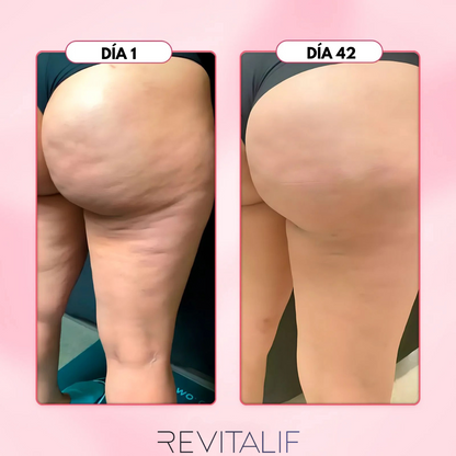 Kit Anticelulítico REVITALIF™